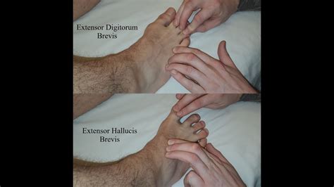 Muscle Palpation Extensor Digitorum Brevis Extensor Hallucis Brevis