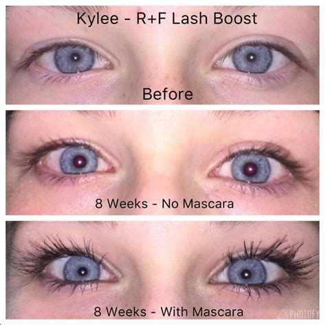13 Year Old Kylie Lash Boost Rodan And Fields Lashes