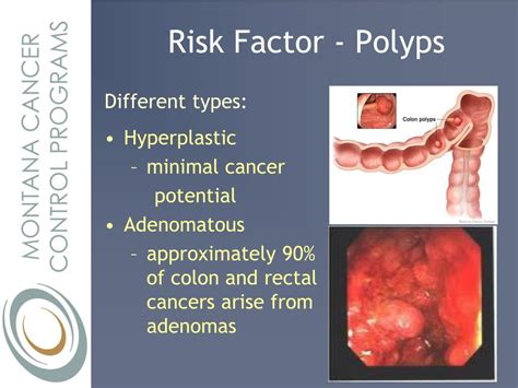 Ppt Colorectal Cancer Screening The Basics Powerpoint Presentation