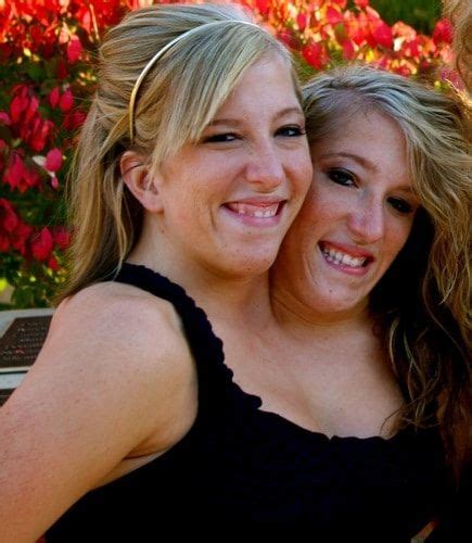 Brittany Famous Conjoined Twins Amazing Facts About The World S