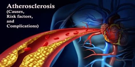 Atherosclerosis Causes Risk Factors And Complications Assignment