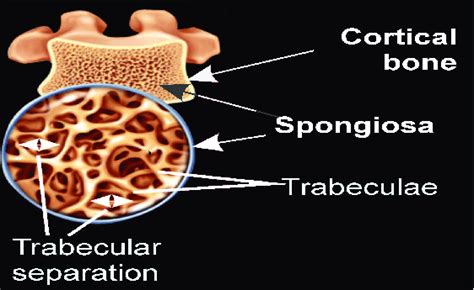 Outer Cortex And Internal Spongy Structure Trabecular Bone Of The