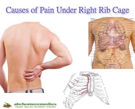 Right side back pain often comes with following symptoms: Causes of Pain Under Right Rib Cage