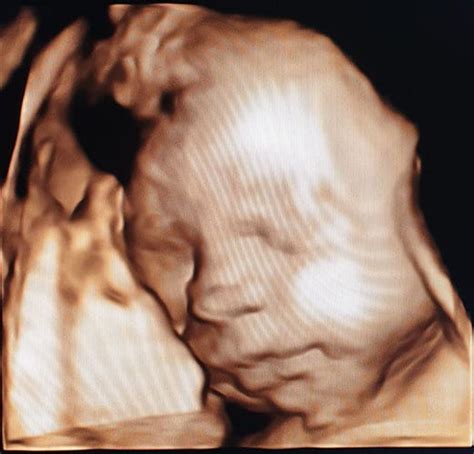 ultraschallbilder mehr als 50 bilder aus der schwangerschaft faminino