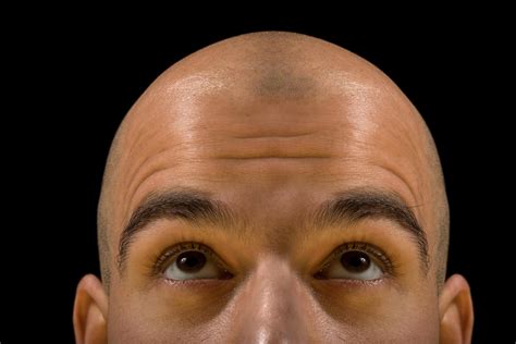 Bald Man Thinking Beauty Smart Care