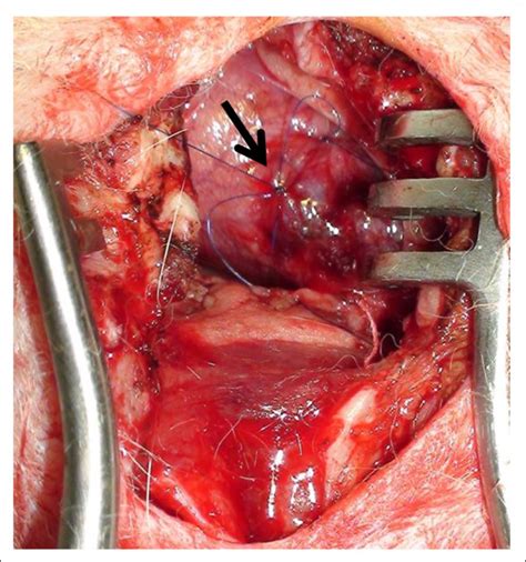 Open Chest Surgical Ligation Emi Model Note The Plain Nylon Suture