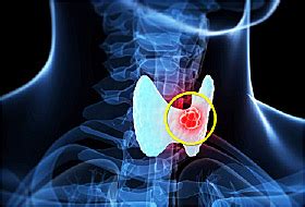 Cancer is the fourth sign of the zodiac, which the sun enters at the summer solstice in the northern hemisphere, on approximately june 21. Simptome durere în gât oboseală pierderea apetitului ...