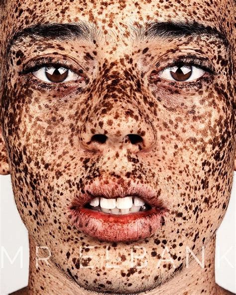 Stunning Portraits Celebrate The Unique Beauty Of Freckled Faces