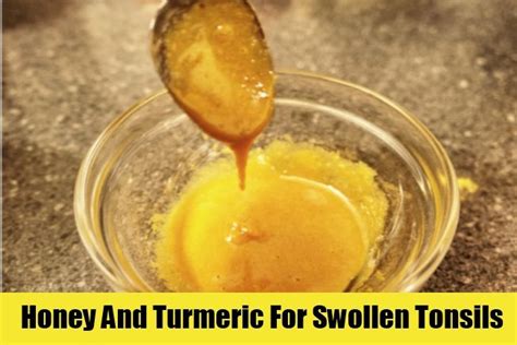 6 Top Home Remedies For Swollen Tonsils Natural Antibiotics Remedies