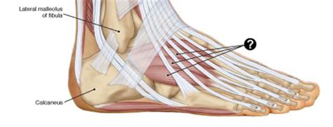 Symptoms may include mild pain after exercise that worsens gradually. Postural and Movement Analysis - Foot - Learn Muscles