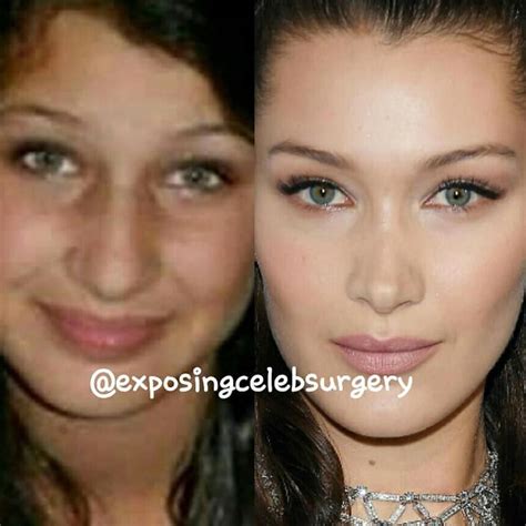 Surgery Photoshop Drama Sur Instagram Bella Hadids Nose Job