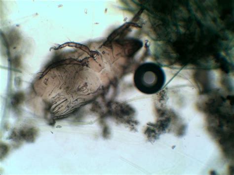 132 Best Eradicating Dustmites Images On Pinterest Dust Mites Home