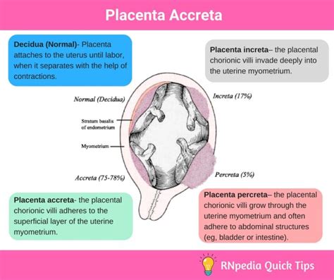 Placenta Accreta Nursing Management Rnpedia