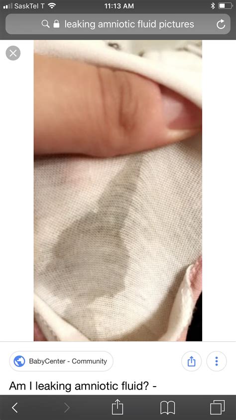 Signs of leaking amniotic fluid - dryryte