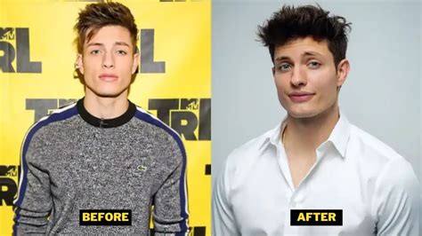Matt Rife Massive Glow Up And Physical Transformation In 2023 Famous