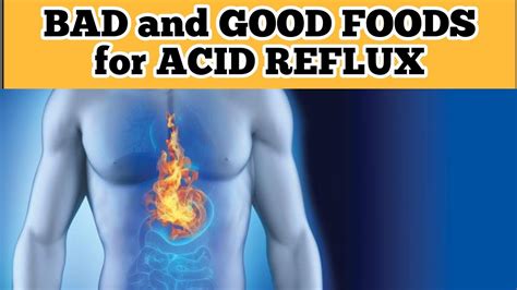 10 Foods To Avoid Acid Reflux And 7 Foods Help Reduce Symptoms Youtube