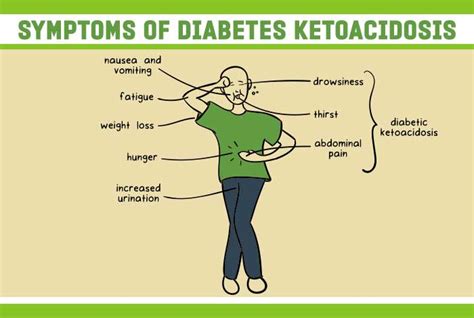 Diabetic Ketoacidosis Diagnosis And Management Faculty Of Medicine