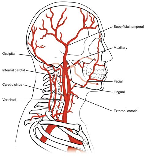 Dissection Of The Carotid And Vertebral Arteries Concise Medical