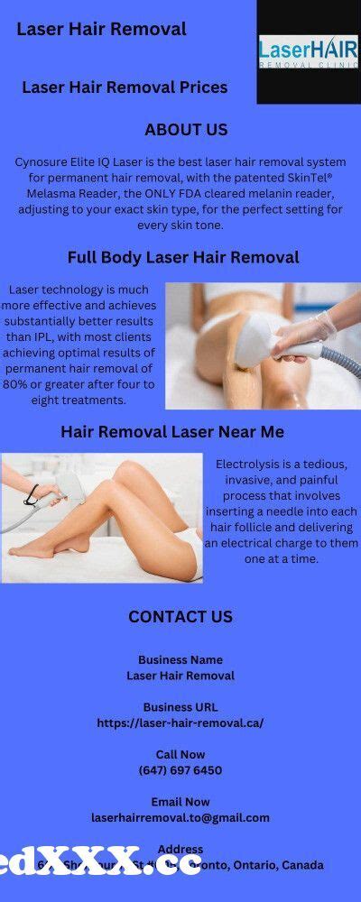 Laser Hair Removal Toronto From Laser Hair Removal From My Friends Hot