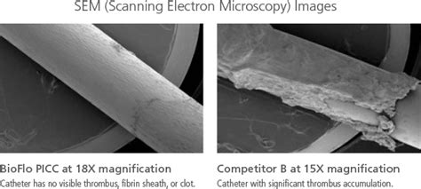 Bioflo Picc By Angiodynamics Flomedical Piccs