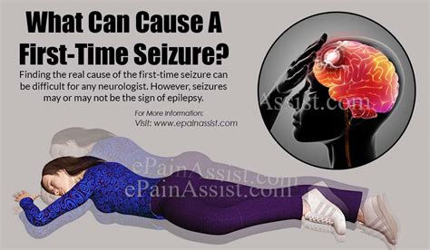 There are two main types of seizures: What Can Cause A First-Time Seizure?