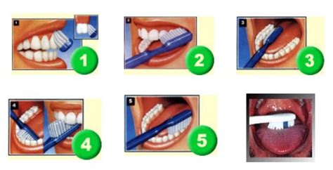Cómo Limpiar Los Dientes Trucos Y Consejos Clínica Dental Pérez