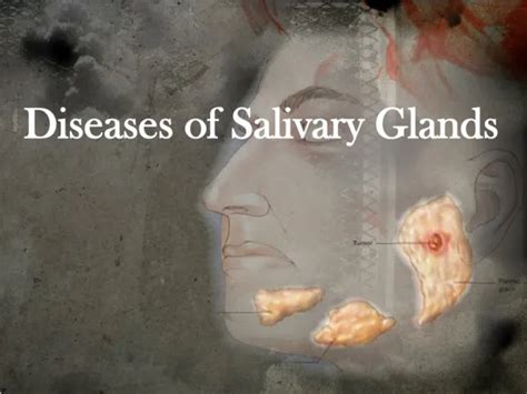 Ppt Salivary Glands And Saliva Powerpoint Presentation Free Download