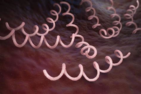 Syphilis Causes Risk Factors Symptoms And Treatment