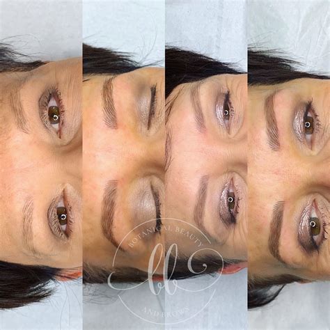 Left To Right Naked Brow Healed After Weeks Right After My XXX Hot Girl