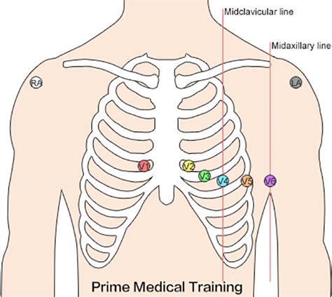 12 Lead Ekg Electrode Placement Prime Medical Training