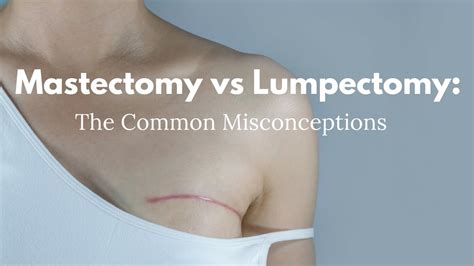 Mastectomy Vs Lumpectomy The Common Misconceptions Youtube