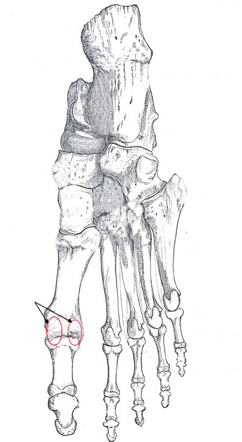 Figure Right Foot Bones Plantar Surface Statpearls Ncbi