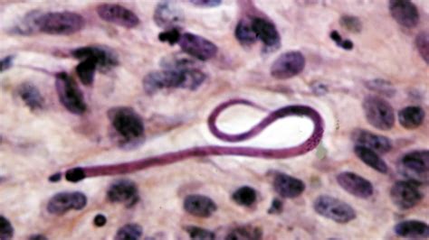 Twip 24 Onchocerca Volvulus A Vector Borne Filarial Nematode This