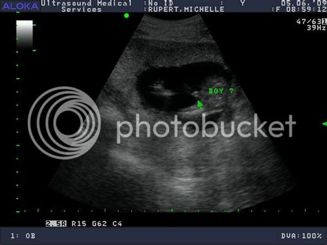 16 Week Elective Ultrasound Boy Babycenter