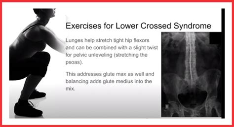 Exercises For Lower Cross Syndrome Liberation