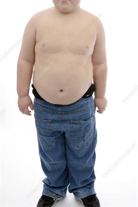 Obesity In A Young Boy Stock Image C0166858 Science Photo Library