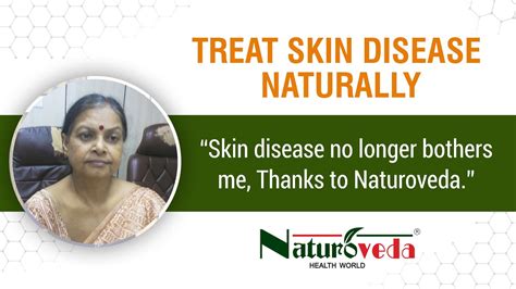 Treat Skin Disease Naturally Natural Cure For Skin Disease Itchy Skin Red Skin Skin Rashes