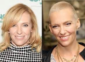 It's late when her dad finally comes home, weary lines around his eyes. Toni Collette (With images) | Shaved head women, Short ...
