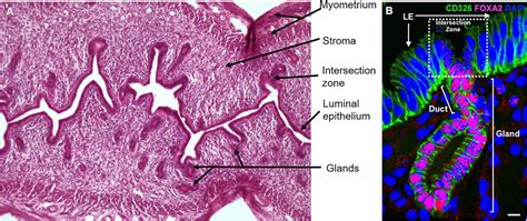 Frontiers The Elusive Endometrial Epithelial Stemprogenitor Cells