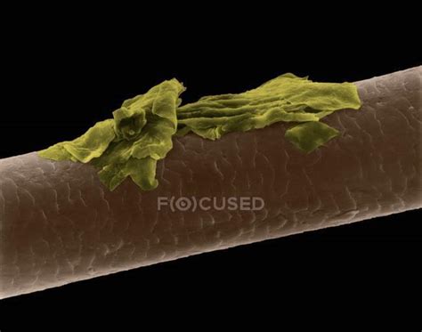Human Hair With Dandruff Coloured Scanning Electron Micrograph Sem