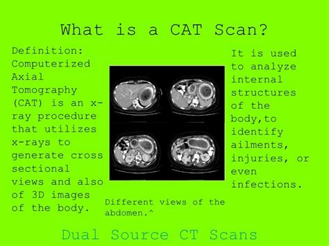 Cat Scans