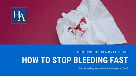 Hemorrhoids Bleeding