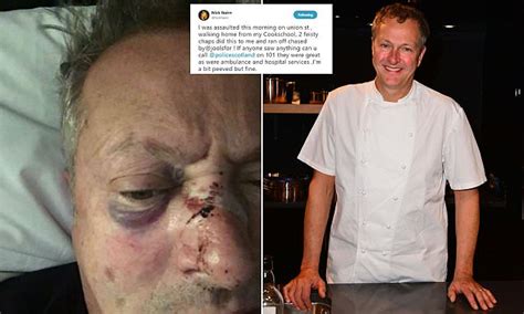 Attack leaves Nick Nairn with black eye and swollen face | Daily Mail