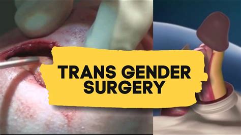Trans Gender Surgery Male To Female Education Youtube