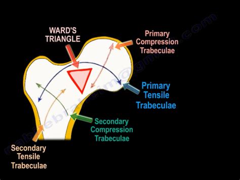 Trabecular Pattern Of The Proximal Femur —