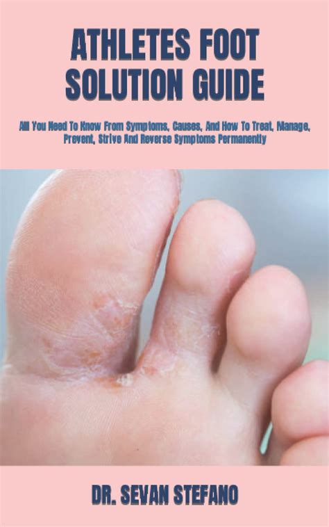 Buy Athletes Foot Solution Guide All You Need To Know From Symptoms