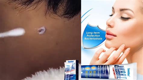 Instant Blemish Removal Gel Sumifun Wart Remover Youtube