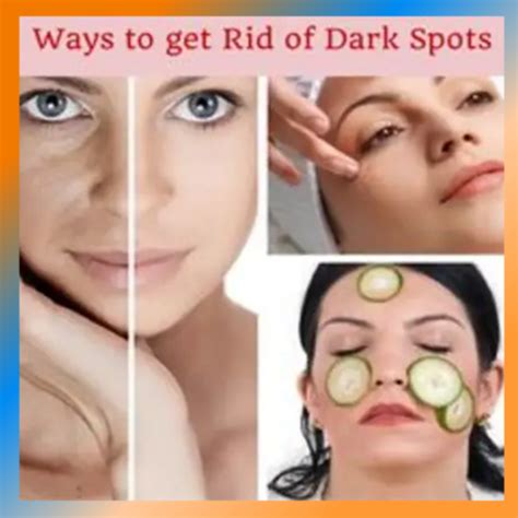 How To Get Rid Of Dark Spots On Your Face Hubpages