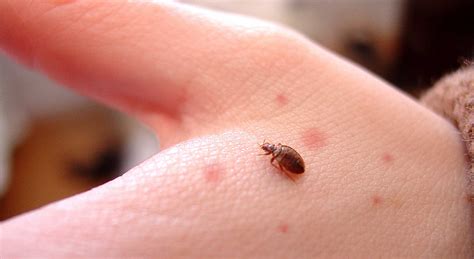 If you've noticed a group of small, itchy, red dots on your skin, it could really be a whole host of things. Bed Bugs vs Hives - How to Tell If It's Just a Bite or an ...