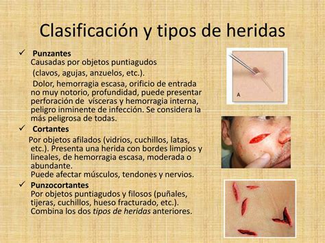 Ppt TraumatologÍa En Clavados Powerpoint Presentation Free Download